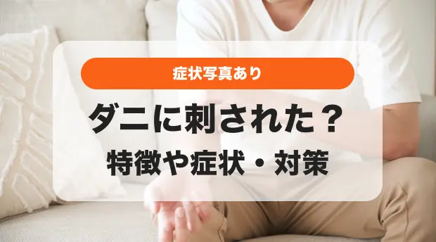 ダニ刺されの特徴のバナー